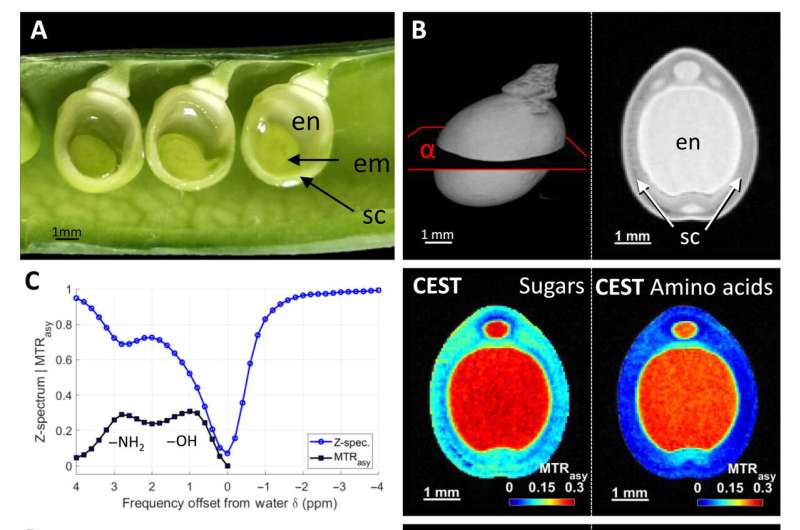 Metabolite imaging using CEST and CSI in developing pea seeds. Credit: Science Advances (2024). DOI: 10.1126/sciadv.adq4424 A milestone in plant magnetic resonance imaging