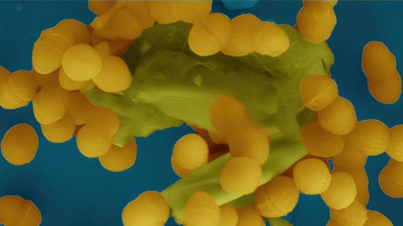 Degradation of cell wall key in the spread of resistance