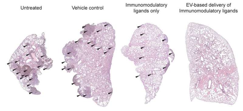 Modified nano-sized cell particles boost cancer immunotherapy, reduce side effects: NUS Medicine study