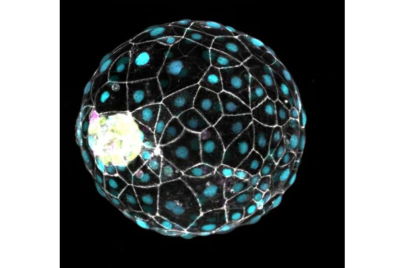 Scientists discover "pause button" in human development